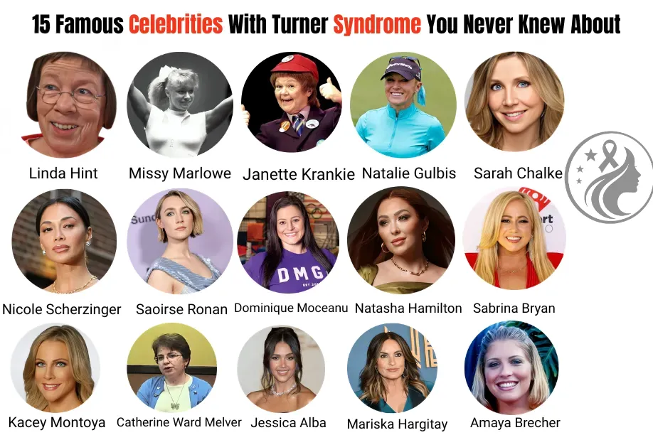 15 Famous People & Celebrities With Turner Syndrome
